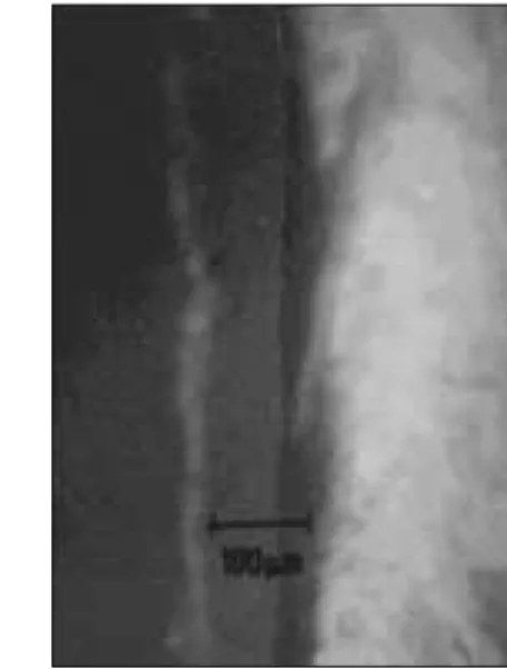 Fig. 13. Observation and comparison of marginal discrepancy using SEM(×34) Fig. 12. Measurement and comparison of the marginal discrepancy using the stereomicroscope