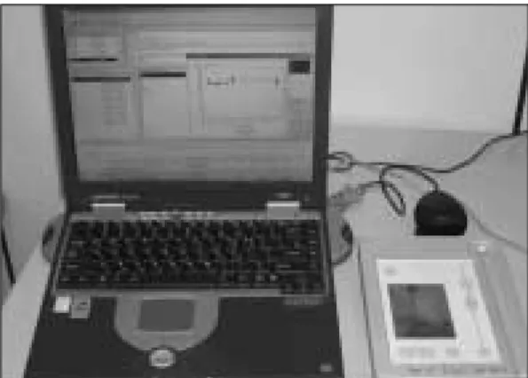Fig. 3. A transducer(Type A1) connection with a stan- stan-dard abutment.