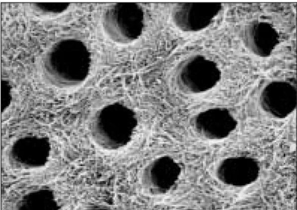Fig. 7. Wet dentin after phosphoric acid etching(5000 times magnification) 