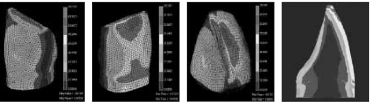 Fig. 15. Natural tooth ; 0.5mm chamfer finish line.