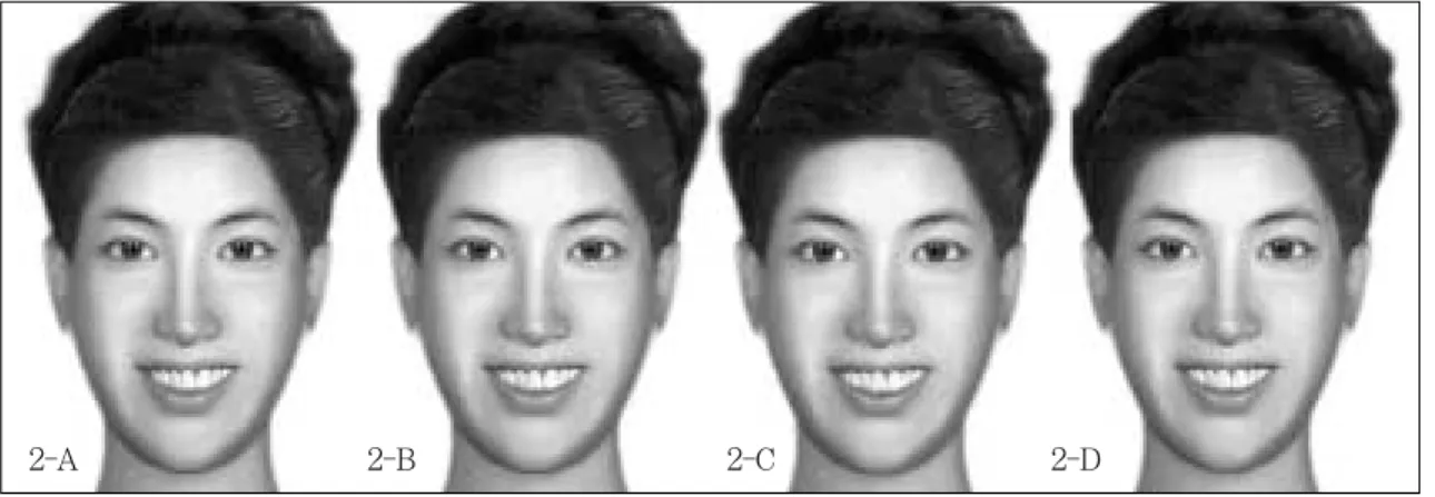 Fig. 5. Non-masked images for the test of  “Midline Deviation” .