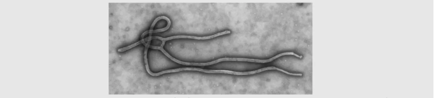 Fig. 1. Colorized transmission electron micrograph(TEM) of the ultrastructural morphology displayed by an Ebola virus virion