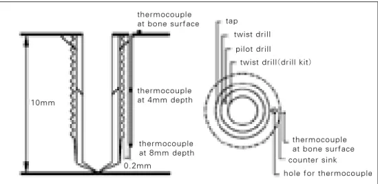Fig. 3. The thermocouple insertion hole, that is 0.9mm in diameter and 8mm in depth, was prepared 0.2mm away from the tapping bur, the last drilling step