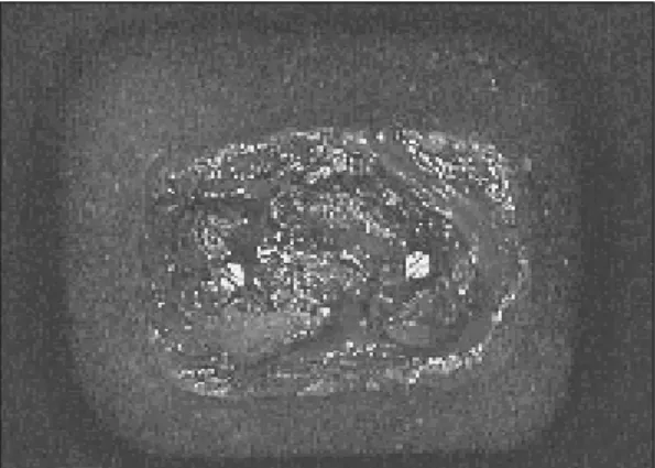 Fig. 7. Cemented strain gauges