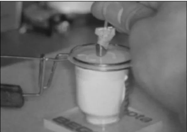 Fig. 7. 내관을 가진 die에서, 외관을 위한 plastic cop- cop-ing을 압접한 후, 외관과 minor connector를 wax up한 다.