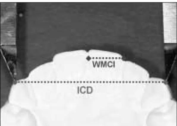 Fig. 2. The measurements of the width of maxillary central incisor (WMCI) and the intercanine distance (ICD)