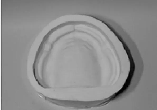 Fig. 3. Complete maxillary denture wax-up for resin base. Fig. 4. Complete maxillary denture wax-up for metal base.