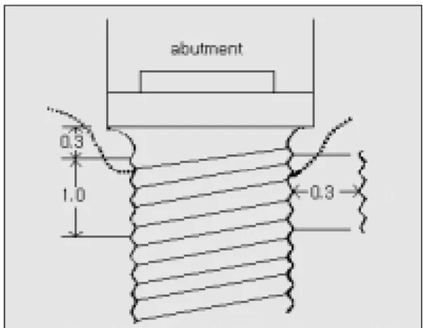 Fig. 1. The reference point was the connecting area between the implant fixture and the implant  abut-ment