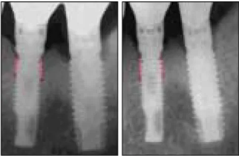 Fig. 3. The analysis procedure of radiographic density.