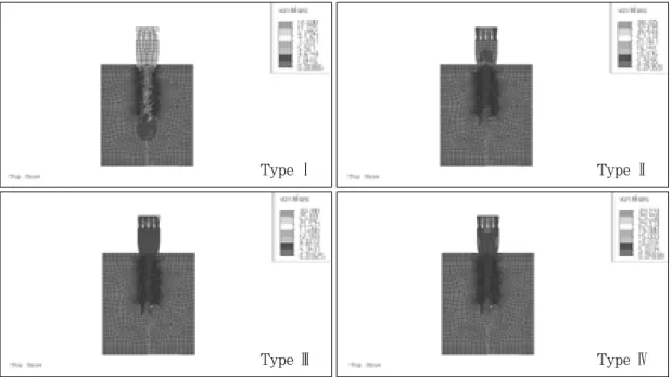 Fig. 27. von Mises stresses in load case 1. (mesio-distal section)
