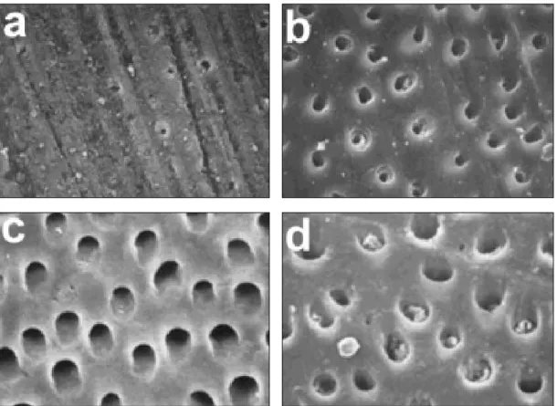 Fig. 2. SEM photographs of differently treated dentin surface.