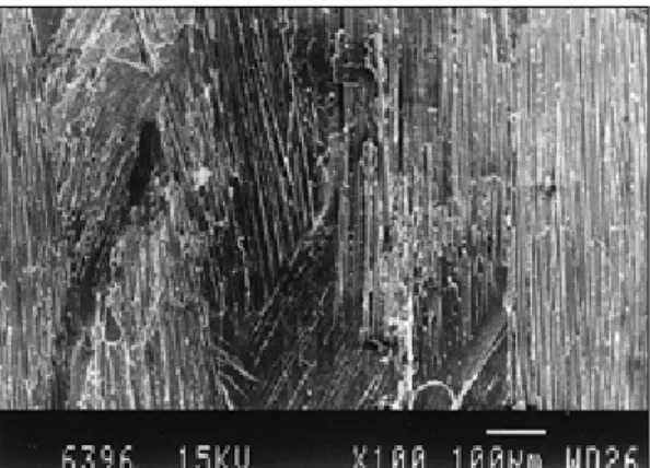 Fig. 16. SEM image of fractured Targis-Vectris crown with high magnification (×1,000).