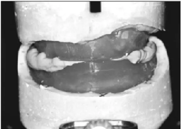 Fig. 5. keeper connection.
