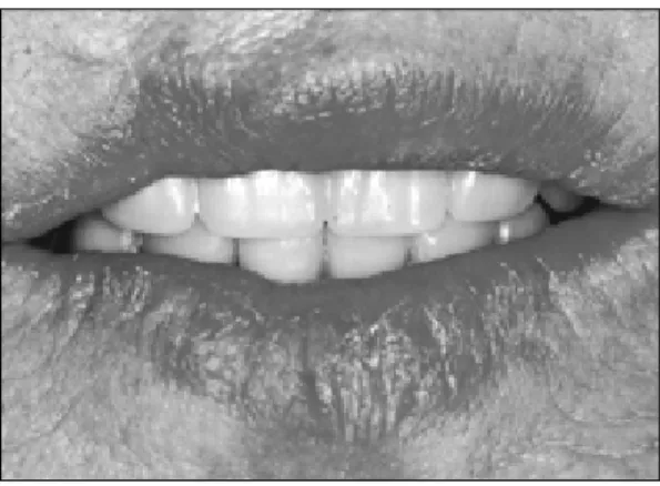 Fig. 8. Anterior view.