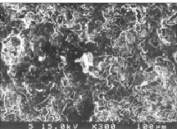 Fig. 4. Verabond surface after ceramic-metal bond test(×300). 