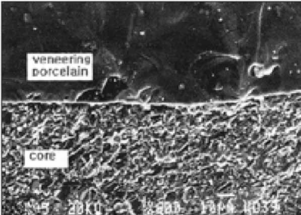 Fig. 8. SEM ×600, (IPS Empress 2 specimen). Fig. 9. SEM ×600, (In-Ceram specimen). 