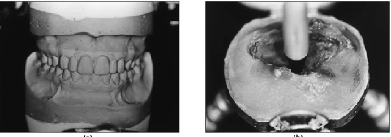 Fig. 10. Laboratory procedure. After mounting customized anterior guide table was fabricated (a),(b).