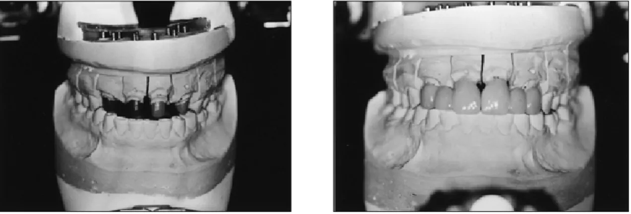 Fig. 11. Frontal view of Empress 2 bridge. 