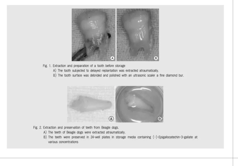 Fig. 1. Extraction and preparation of a tooth before storage 