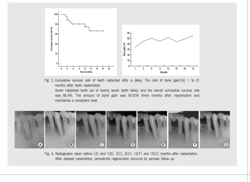 Fig. 3. Cumulative  survival  rate  of  teeth  replanted  after  a  delay.  The  rate  of  bone  gain(%)  1  to  21 months after tooth replantation