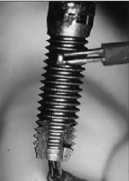Fig. 2. H-A coated implant with two thermocouplesFig. 1. pure titanium implant with two thermocouples