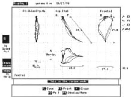 Fig. 7. The analysis criteria of chewing cycle.