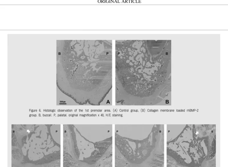 Figure  6.  Histologic  observation  of  the  1st  premolar  area.  (A)  Control  group,  (B)  Collagen  membrane  loaded  rhBMP-2 group