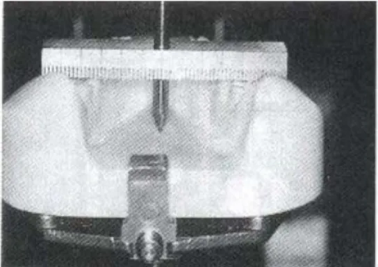 Fig. 3. The establishment of standard occlusal plane. Fig. 4. The establishment of standard axis.