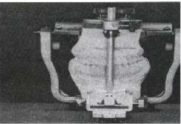 Fig. 2. Construction of the gnathological cast by articulator mounting
