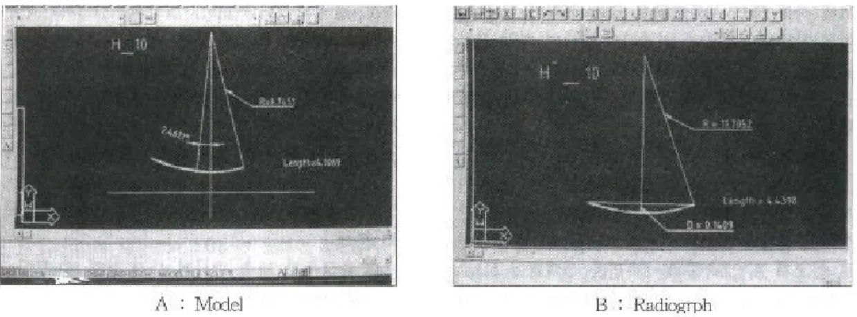 Fig. 8. Tracing lateral cephalometric radiograph and marking on the measuring points