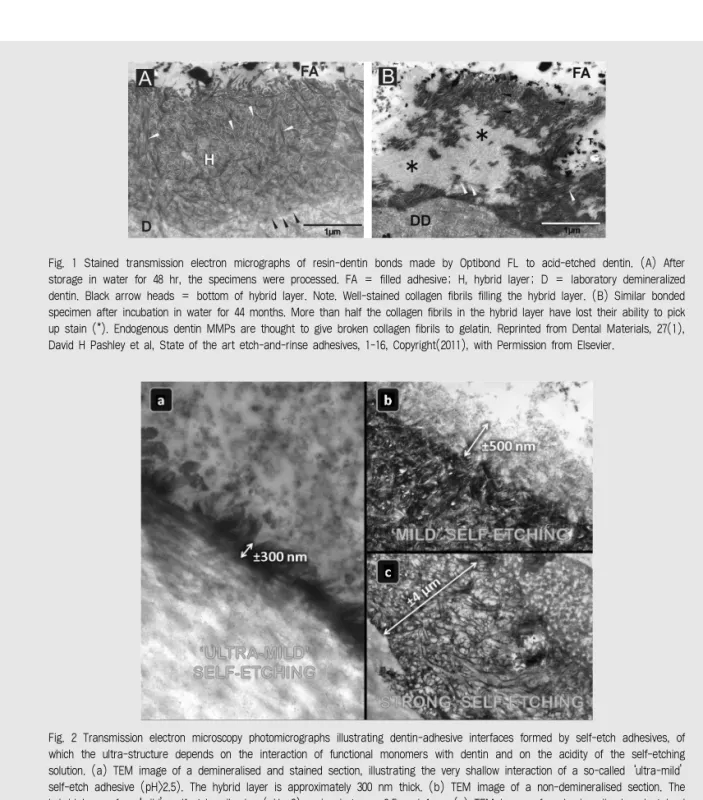 Fig.  1  Stained  transmission  electron  micrographs  of  resin-dentin  bonds  made  by  Optibond  FL  to  acid-etched  dentin