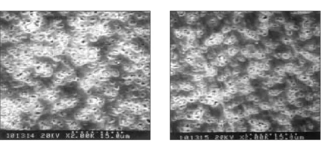 Fig. 2. Scanning electron micrographs of T1 ingot(left: specimen using single sprue, right: specimen using double sprue) according to sprue type