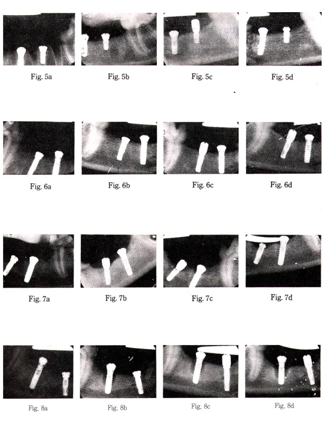 Fig. 8a Fig. 8b Fig. 8c Fig. 8d
