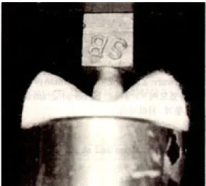 Fig. 6. Cementation of the IPS-Empress ceramic crown on metal die