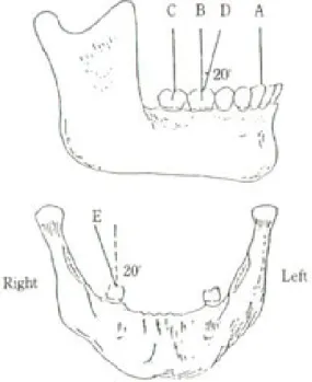 Fig. 1. Occlusal load directions(A : vertical load on canine, B : Vertical load on 1st