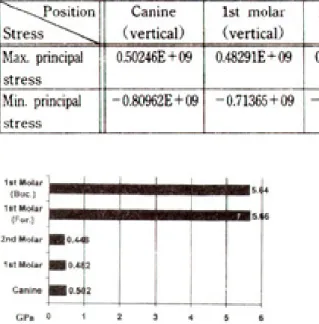 Table Ⅳ. Principal stresses in the working condyles(Pa)