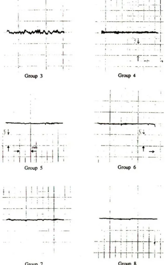 Fig 4. Representative surface profile tracing of each specimen and each group