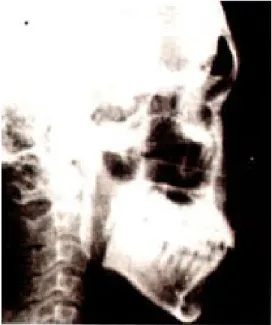 Fig. 1. Lateral cephalogram
