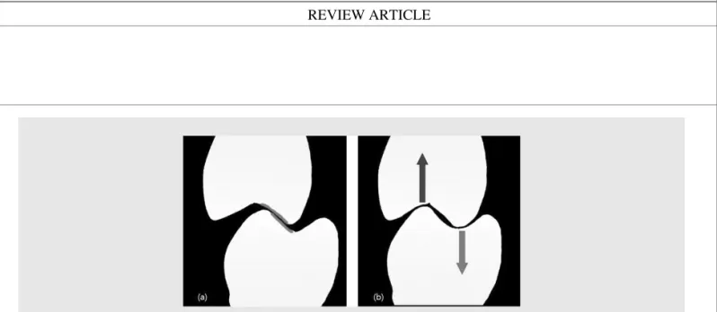 Fig. 15. (a) Occlusal adjustment for balancing interference. (b) After occlusal adjustment, direction of force can be coincide with the vertical axis of implant.