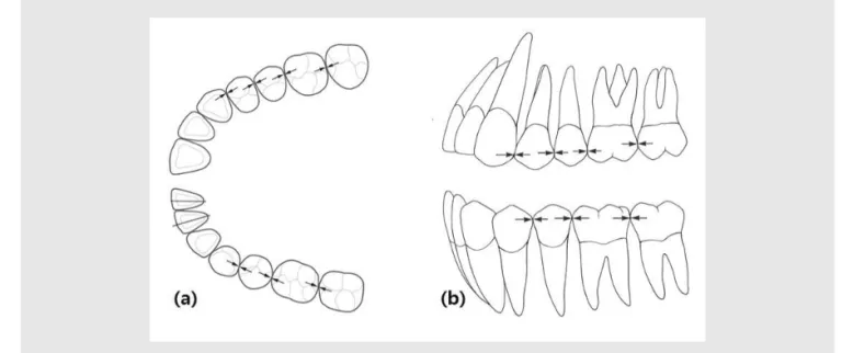 Fig. 1. Ideal proximal contact position. (a) In occlusal views, proximal contact positions are located central area excluding the maxillary premolar area