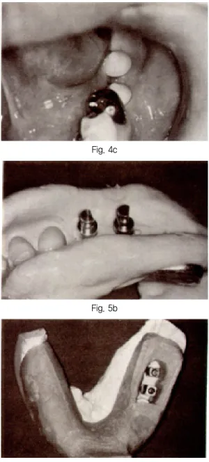 Fig. 4b Fig. 5a Fig. 5c Fig. 5e Fig. 4cFig. 5bFig. 5dFig. 5f논문사진부도 ③