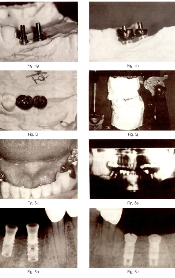 Fig. 5g Fig. 5i Fig. 5k Fig. 5hFig. 5jFig. 6a논문사진부도 ④