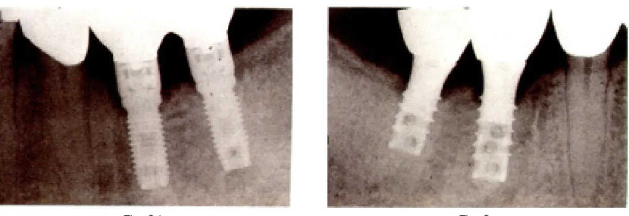 Fig. 6d Fig. 6e