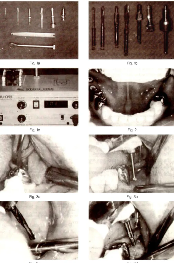 Fig. 1a Fig. 1c Fig. 3a Fig. 3c Fig. 1bFig. 2Fig. 3bFig. 3d논문사진부도 ①