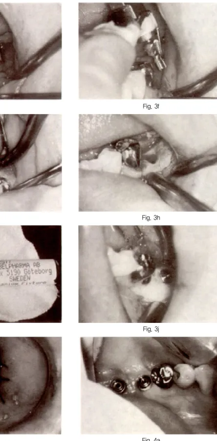 Fig. 3e Fig. 3g Fig. 3i Fig. 3f Fig. 3hFig. 3j논문사진부도 ②