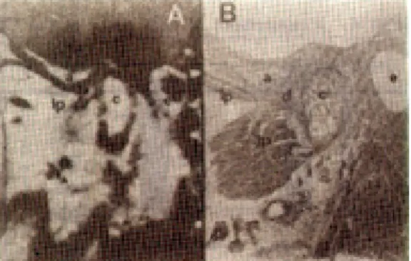 Fig. 9. MR  image  and  histologic  section  of  normal TMJ.