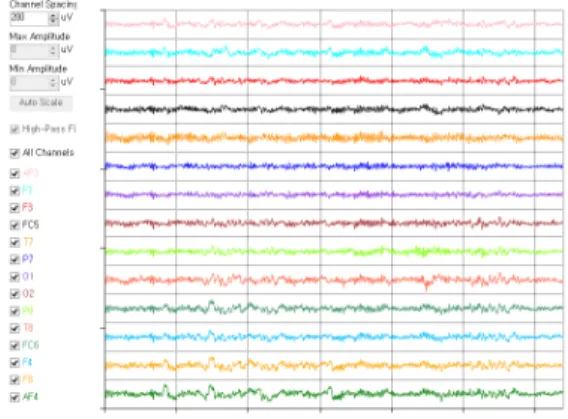 Fig.  1  Electrode  location  for  EEG  signal