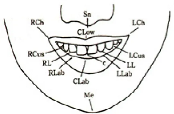 Fig. 1. Photograph in a full smile Fig. 2. Landmarks used to evaluate the lip-tooth relationship of the smile