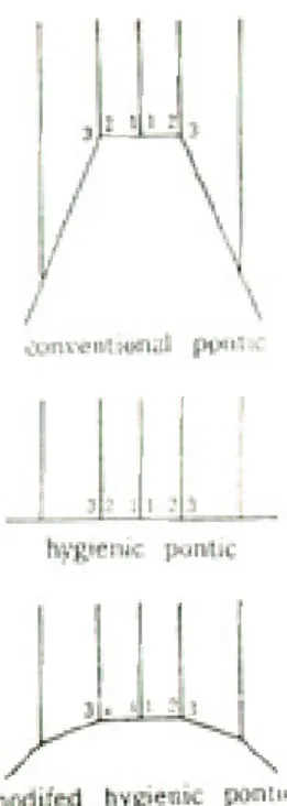 Table 2. Maximum stress at the inferior 3-point of middle portion in each group