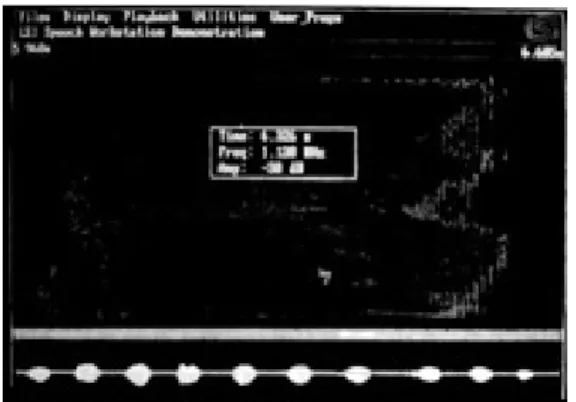 Fig. 2. A view of BioPak jaw tracker attached to the informant
